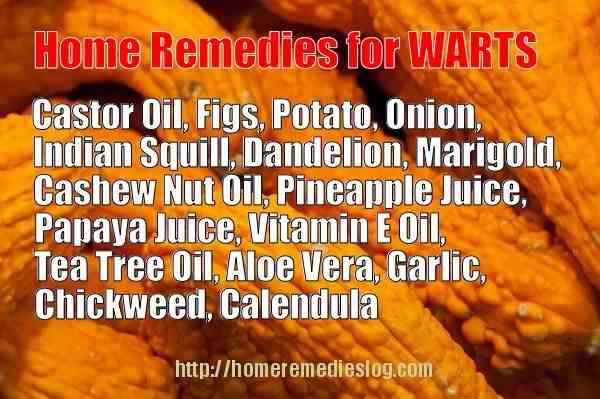 home remedies for warts - meme