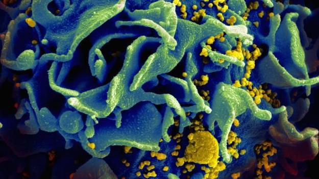 Potential-AIDS-cure-would-make-HIV-virus-self-destruct