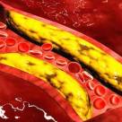 How to Lower Cholesterol Naturally with the Right Foods