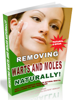 Removing Warts and Moles Naturally!