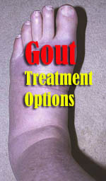 gout-treatment-options