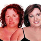Fighting Rosacea the Ayurvedic Way
