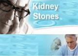 51 ways to deal with kidney stones