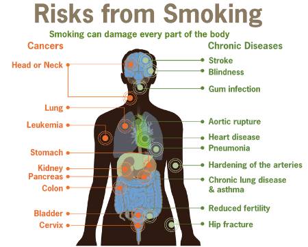 Risks_form_smoking-smoking_can_damage_every_part_of_the_body