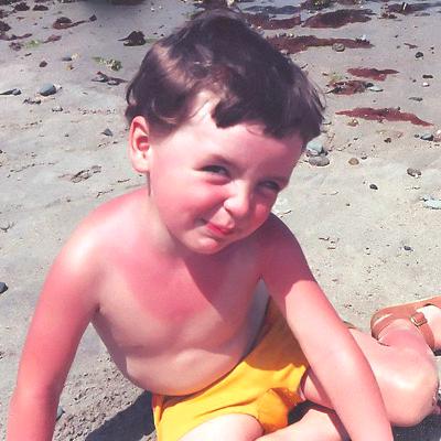 Little boy with sunburn sitting on the beach