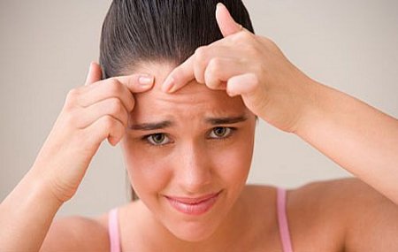 Girl squeezing a pimple on her forehead (not gross)