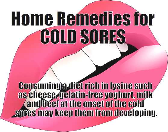 home remedies for cold sores - meme