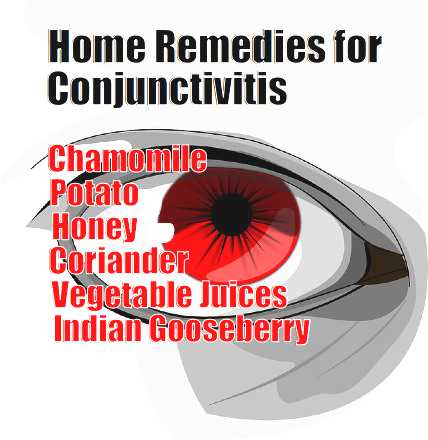 home remedies for conjunctivitis - meme