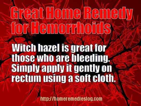 home remedies for hemorrhoids - meme