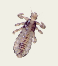 head lice image
