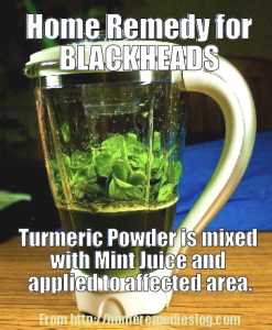 home remedy for blackheads - meme