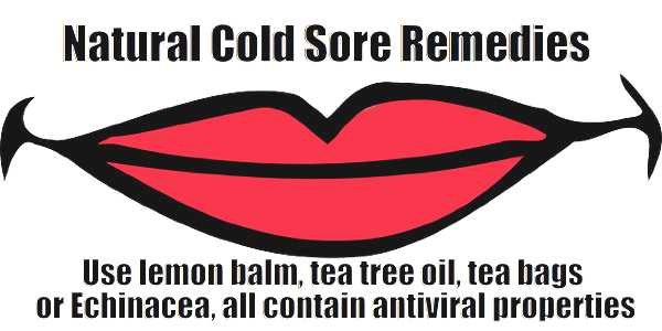 natural cold sores remedies memeoptimized