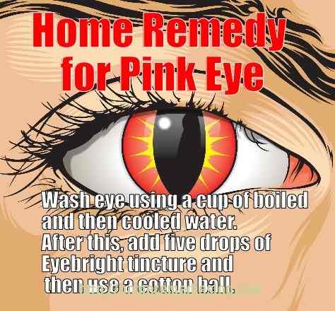 home remedy for pink eye - meme 