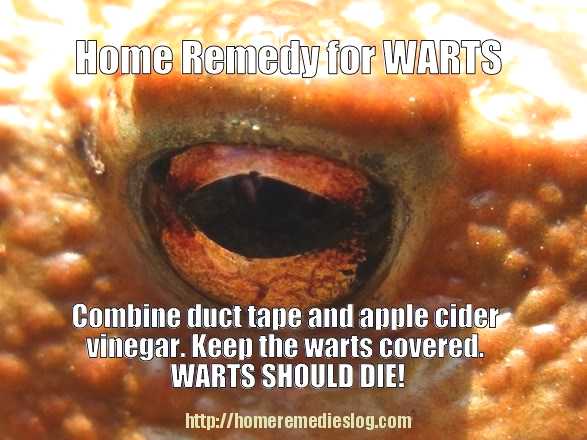 duct tape home remedy for warts - meme