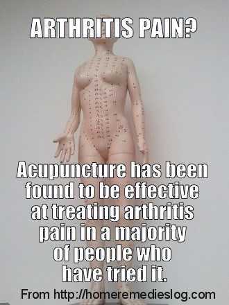 acupuncture for arthritis memeoptimized