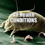 disease and health conditions