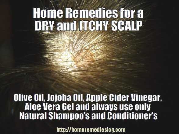 Taking Care of a Dry Itchy Scalp