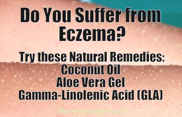 eczema-remedies-memeoptimized