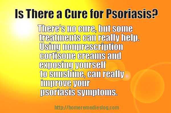 Is Psoriasis Contagious? – Condition Facts
