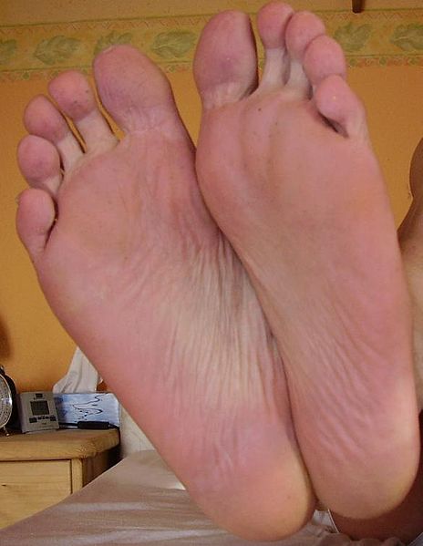 Fixing Faulty Feet – The Causes and Cures of Common Foot Problems