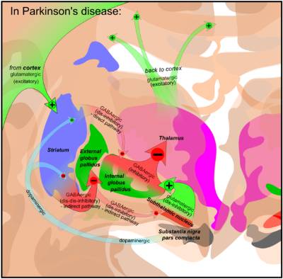 Basal_ganglia_in_Parkinson's_disease